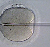 In-Vitro-Fertilisation