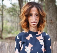 Lizzie Velasquez